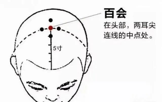 得了外阴白斑冬天吃什么才比较养生?