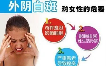 外阴白斑分几种?