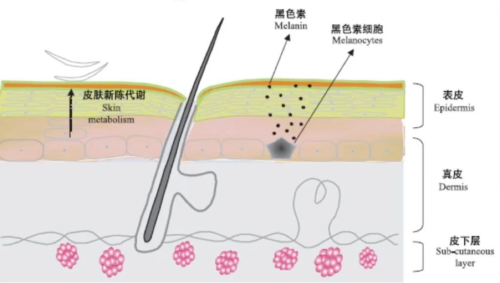 增生型外阴白斑有哪些明显的症状?