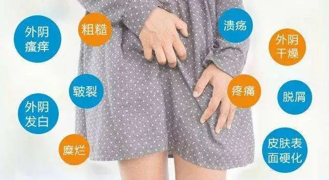 外阴白斑为什么会导致外阴瘙痒?