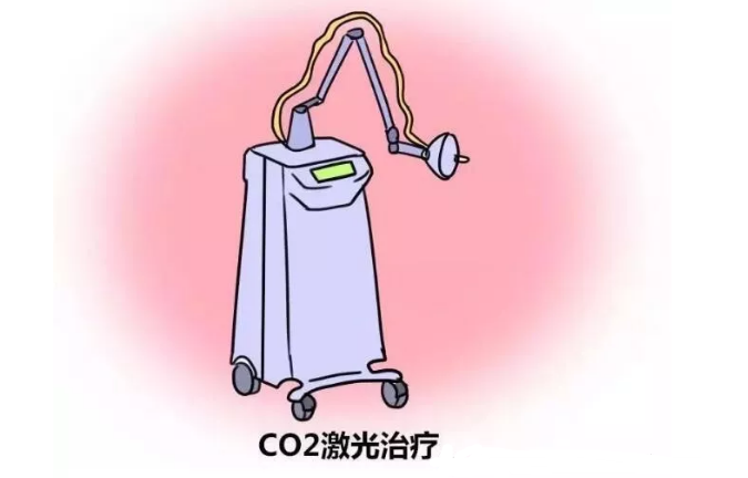 激光治疗外阴白斑疾病的弊端?